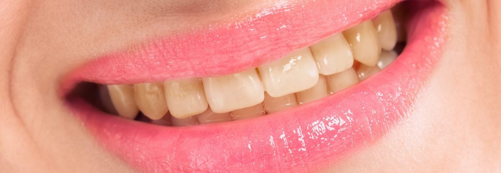 Dentista Girona