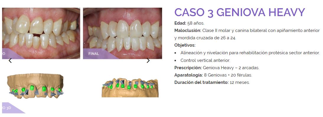 Caso clínico